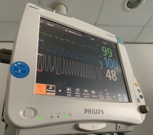 Heart rate monitor in hospital uses electrode pads to capture the heart's electric activity