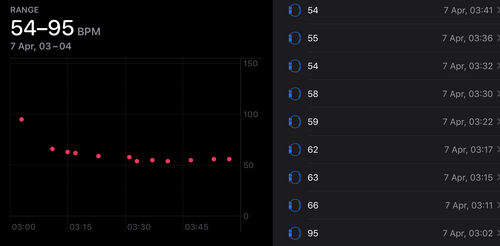 Limitations of sleep tracking using a wearable Comparison with a chest strap HR monitor