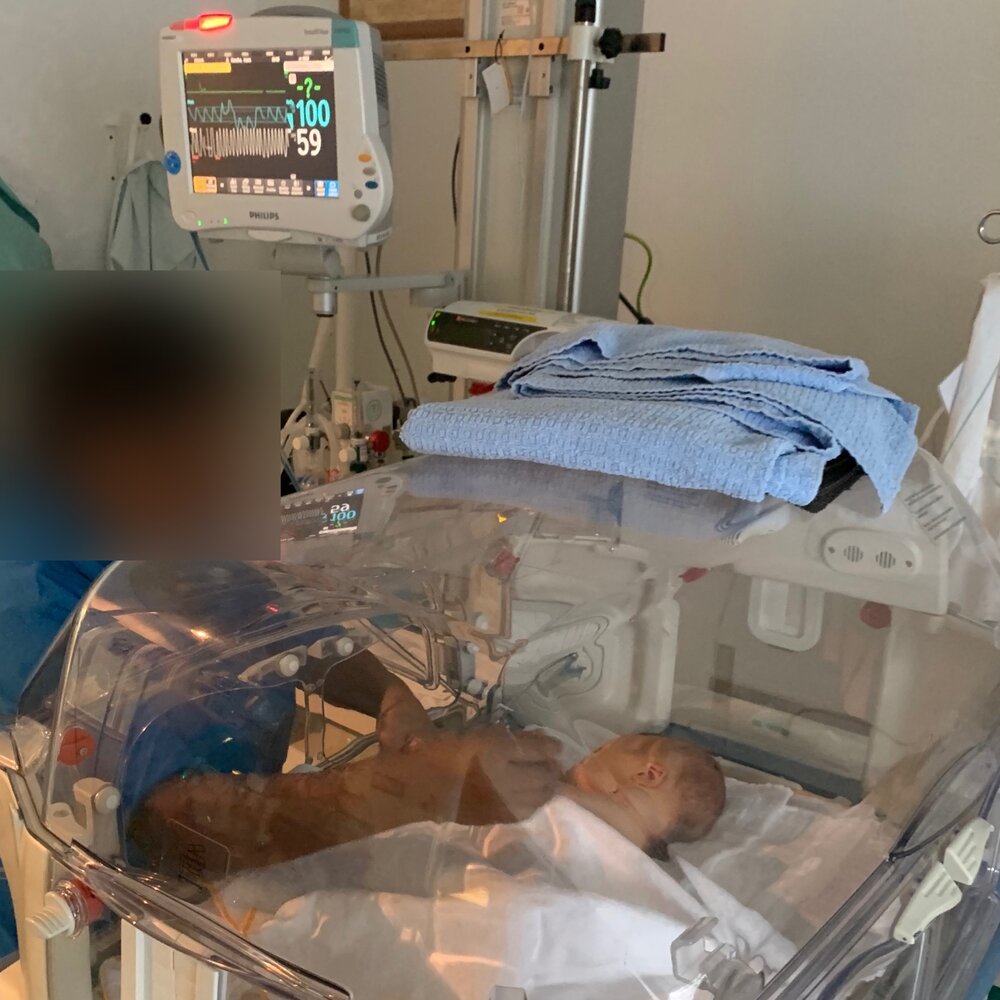 Die Rettung unseres Sohnes – beachte den Herzfrequenzmonitor, der keine Herzaktivität erkennen kann (das grüne Fragezeichen)...